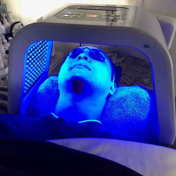 sharone-skin-specialist-led-light-therapy-blue
