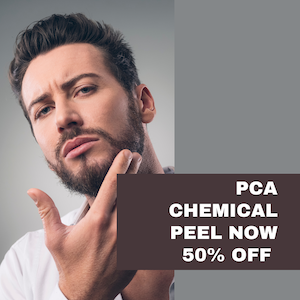Sharone Skin Specialist 50% off on PCA CHEMICAL PEEL
