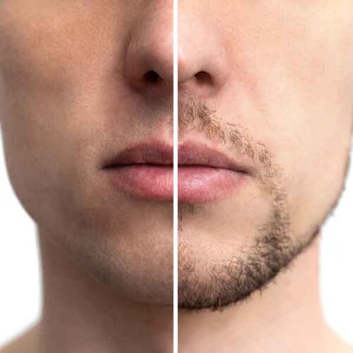 sharone-skin-specialist-grooming-male-before-and-after